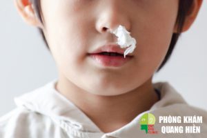 Mũi bị chảy máu