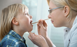 viêm amidan cấp mủ ở trẻ em