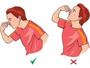 nguyên nhân chảy máu cam