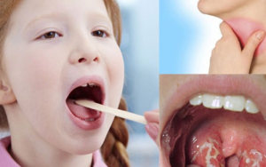 khám tai mũi họng cho trẻ ở đâu tốt