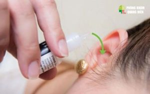 trị nấm tai bằng oxy già